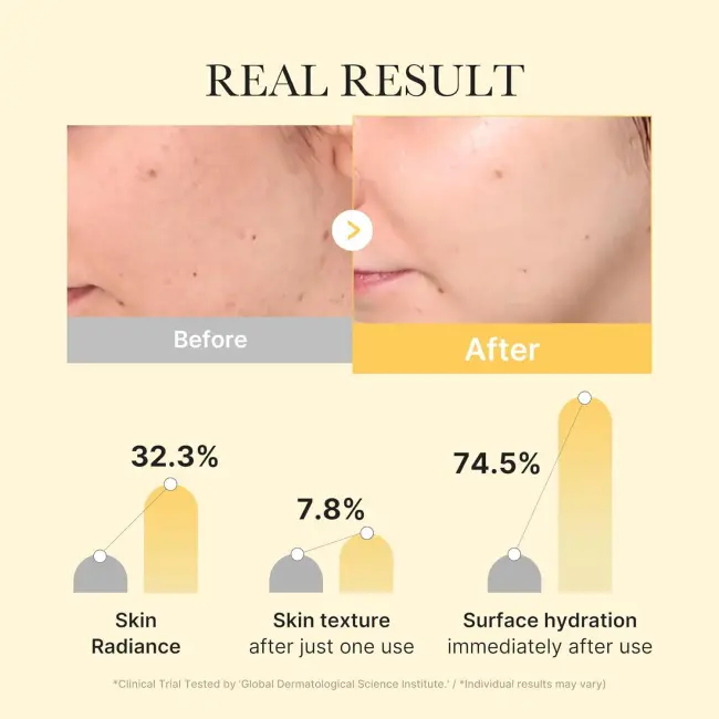 KOJIC ACID TURMERIC BRIGHTENING GEL MASK 28G